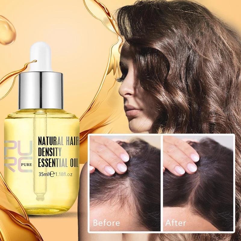 Purc hair density growth products prevent hair loss oil for Men Women - ARI