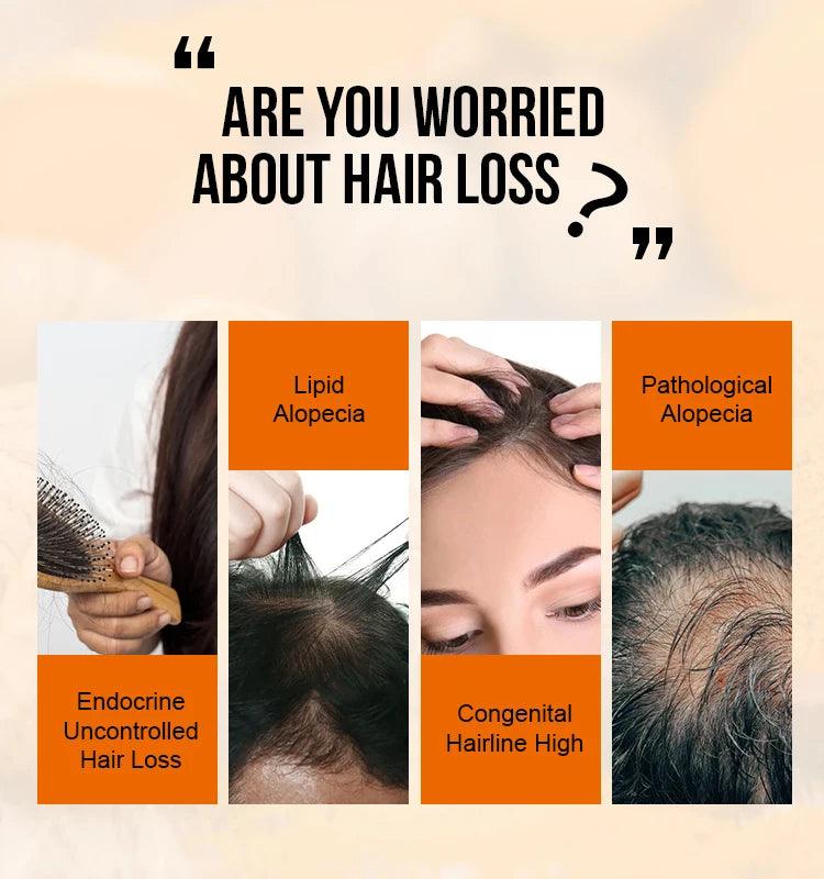 Purc hair density growth products prevent hair loss oil for Men Women - ARI