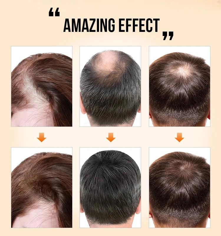 Purc hair density growth products prevent hair loss oil for Men Women - ARI